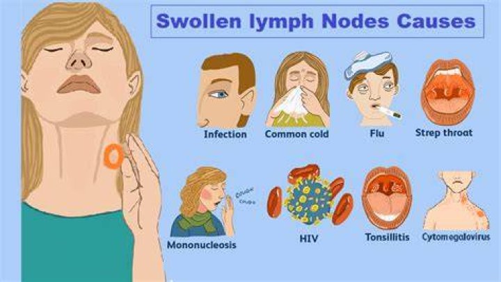 Can a cold cause swollen lymph nodes?