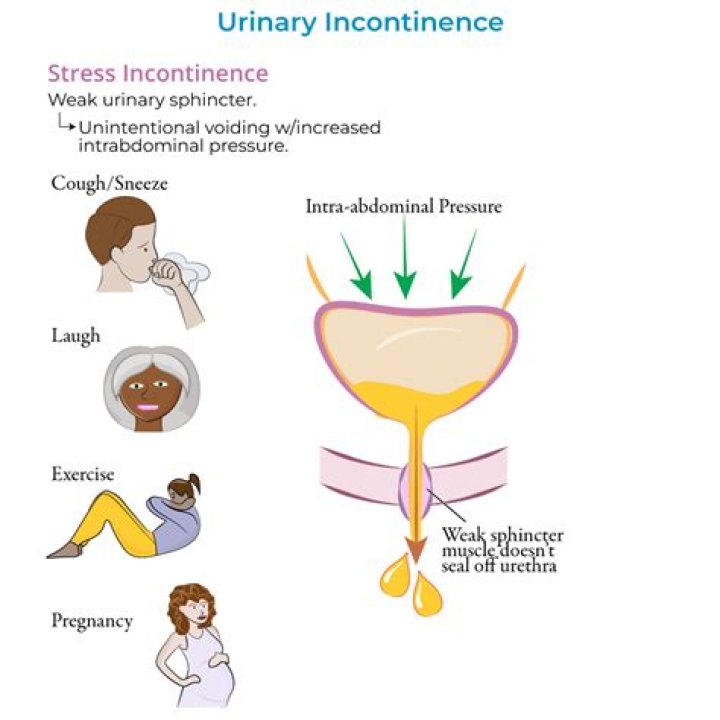 Can a seizure cause urinary incontinence?