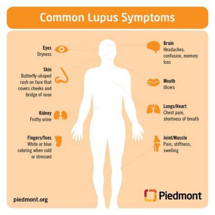 Can lupus cause extreme fatigue?