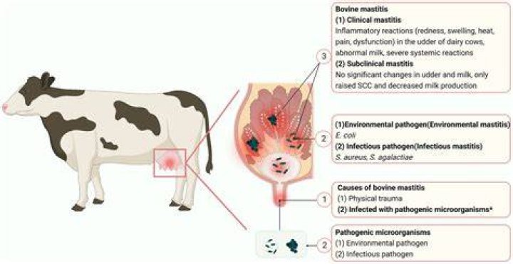 Can tuberculosis cause mastitis?