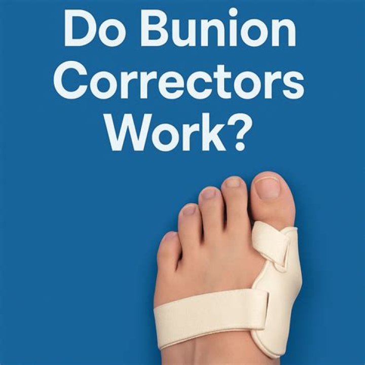 Do bunion correctors really work?