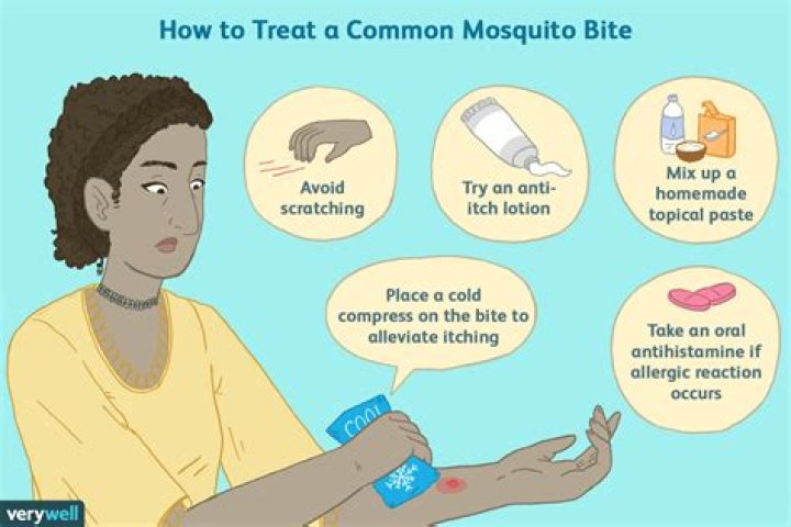 How do you get rid of mosquito bites on your legs?