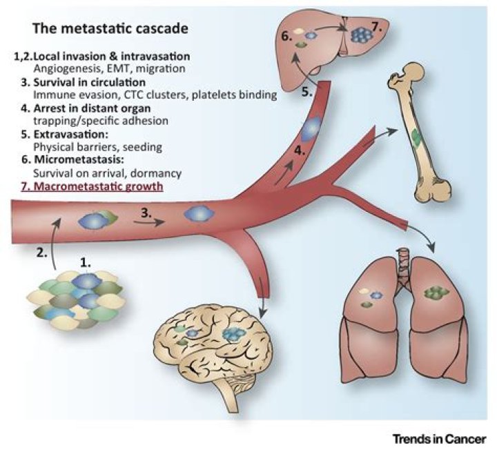 How do you know if a tumor has metastasized?