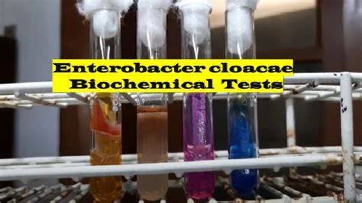 How do you test for Enterobacter cloacae?