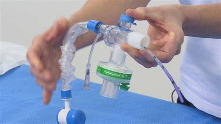 How do you ventilate a patient with a tracheostomy?
