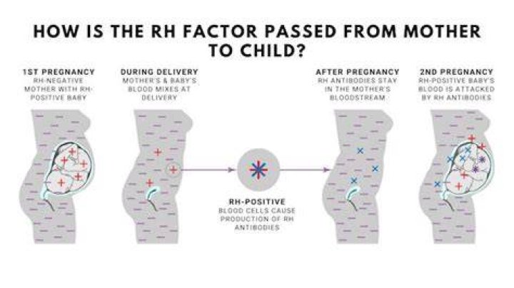 How does being Rh-negative affect second pregnancy?
