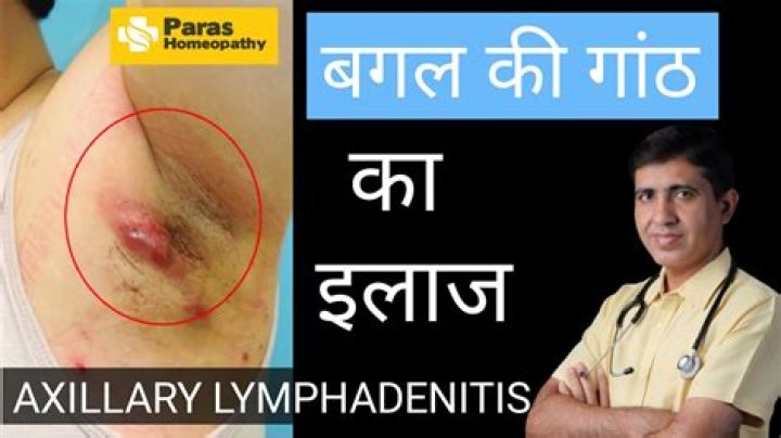 How is axillary lymphadenitis treated?