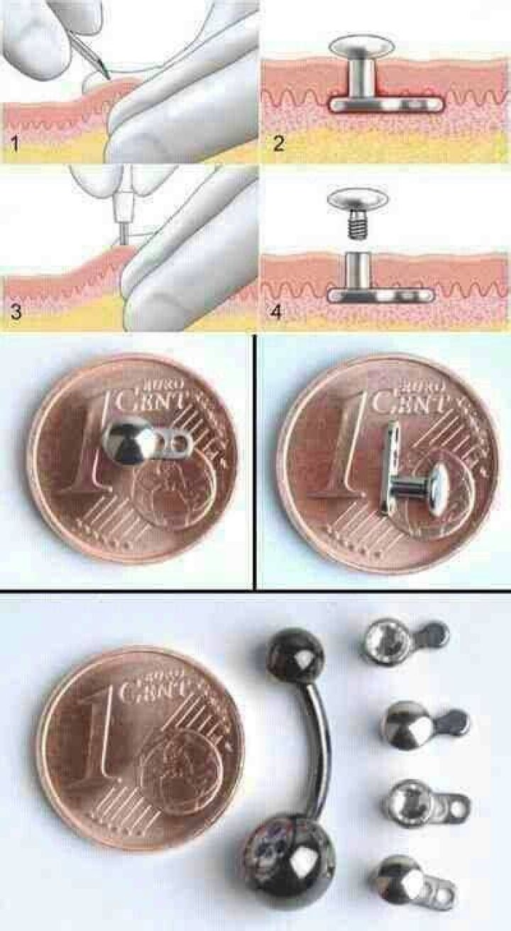 How long do dermal anchors take to heal?