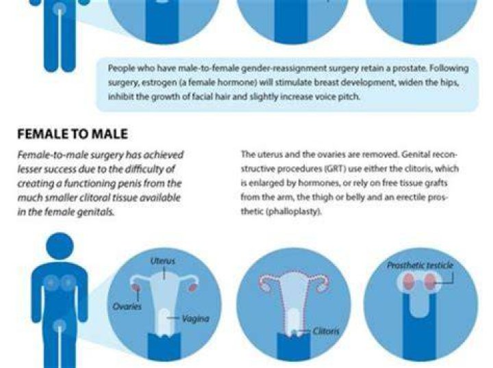 How much does it cost to turn from male-to-female?