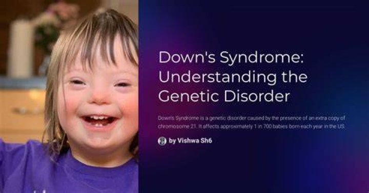 Is arthritis common in Down syndrome?