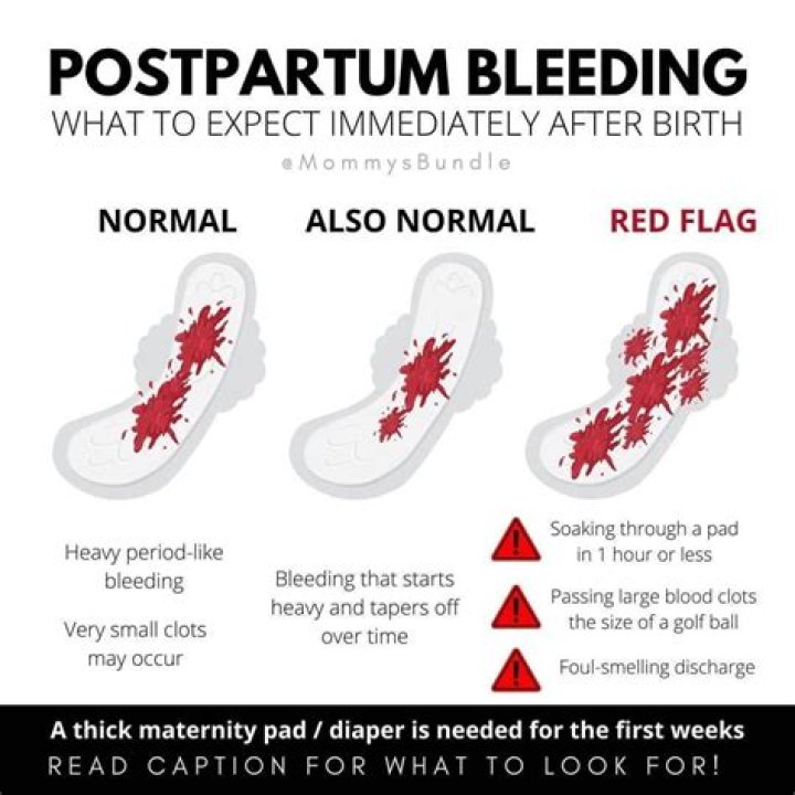Is it normal to bleed on and off 6 weeks postpartum?