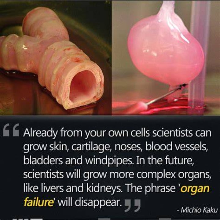 Is it possible to grow your own organs?