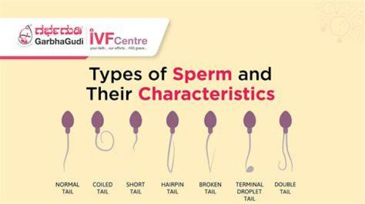 Is male sperm different from female sperm?