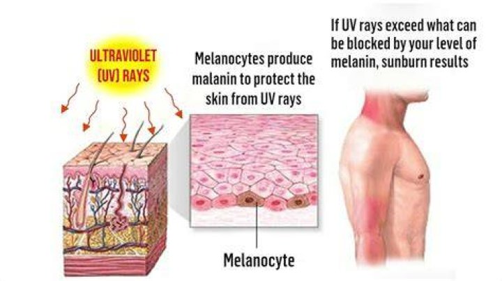 What are 5 harmful effects of UV rays on humans?