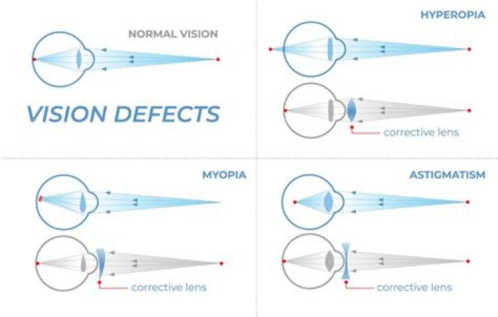 What are eye defects and their correction?