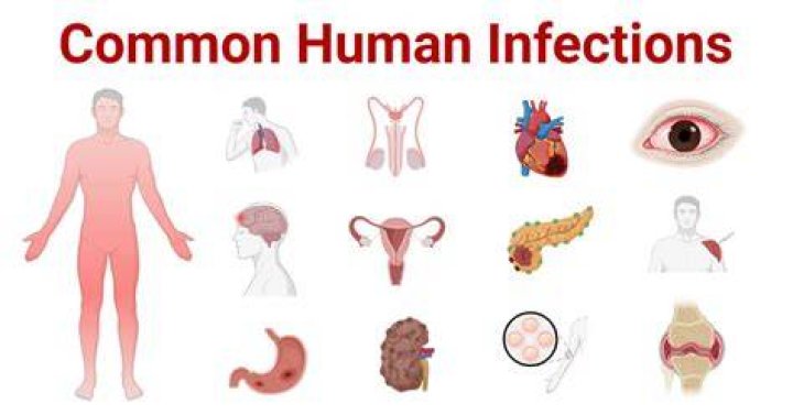 What are the most common sources of infection?