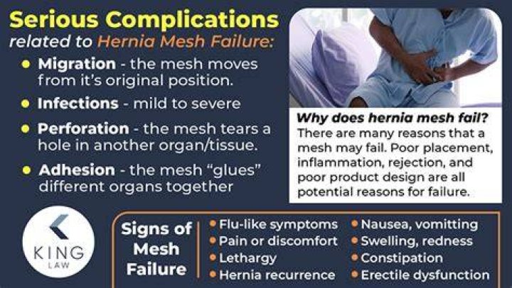 What does a failed hernia mesh feel like?