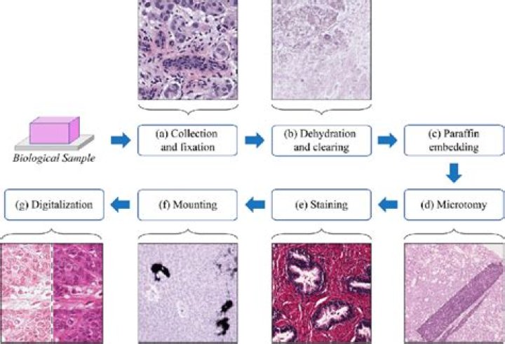 What does a histology tech make?