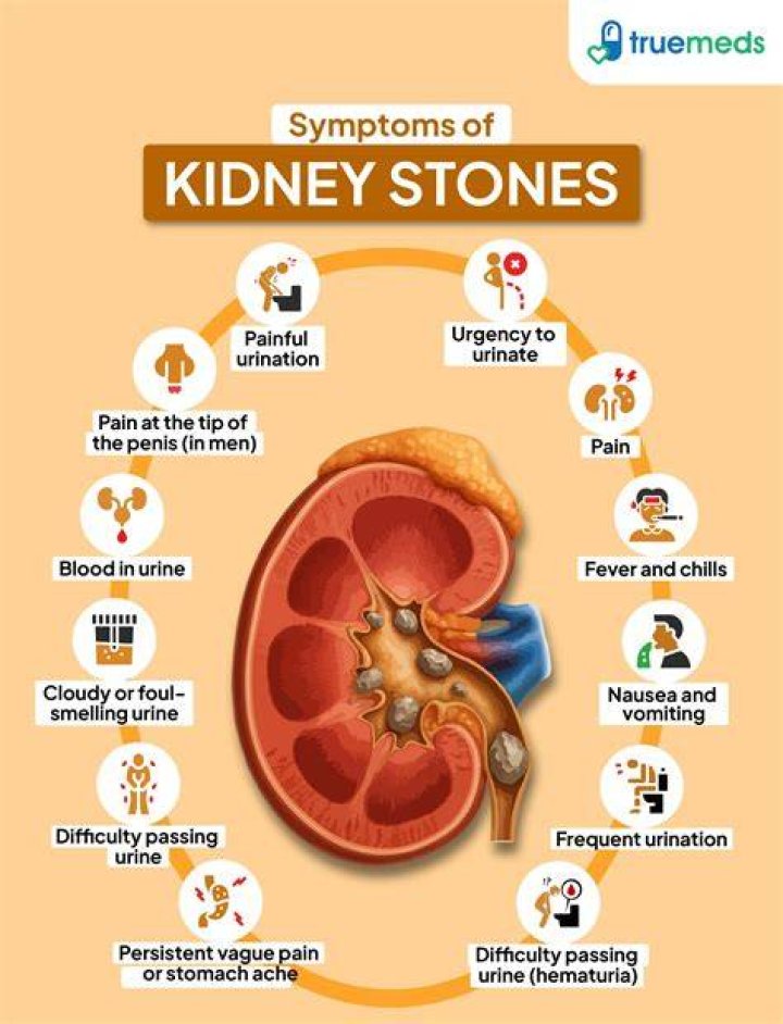 What does a kidney stone coming on feel like?