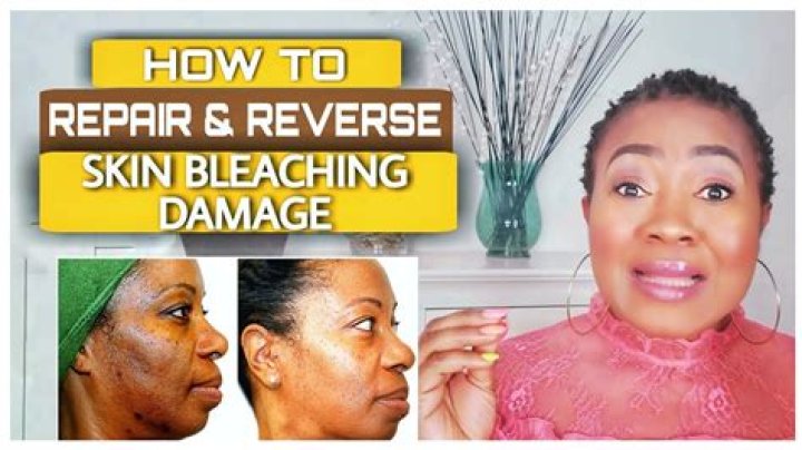 What does bleach do to black skin?