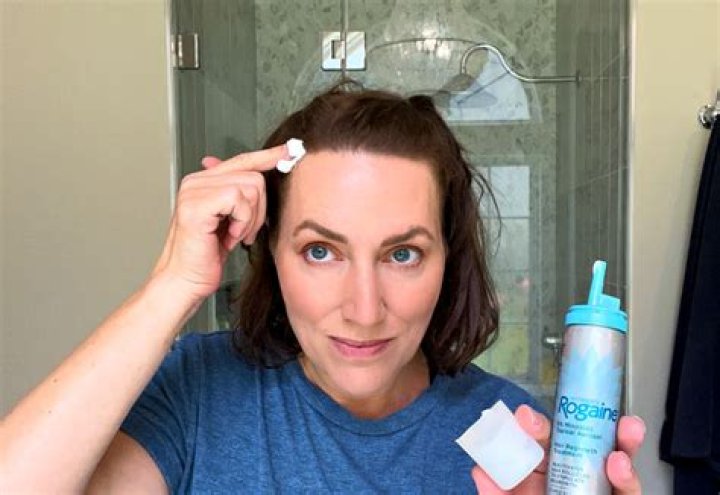 What female celebrities use Rogaine?