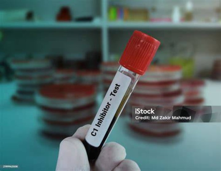 What is a C1 inhibitor blood test?