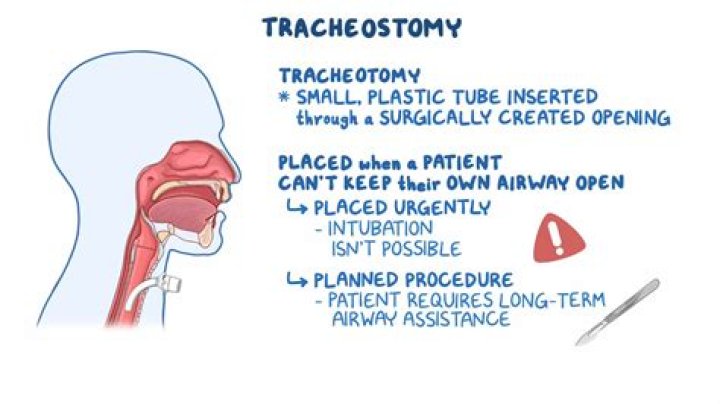 What is a tracheostomy and why is it done?