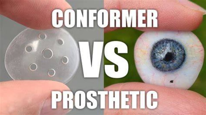 What is an eye conformer used for?