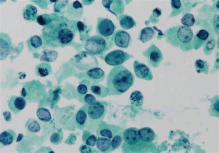 What is Decoy cells?