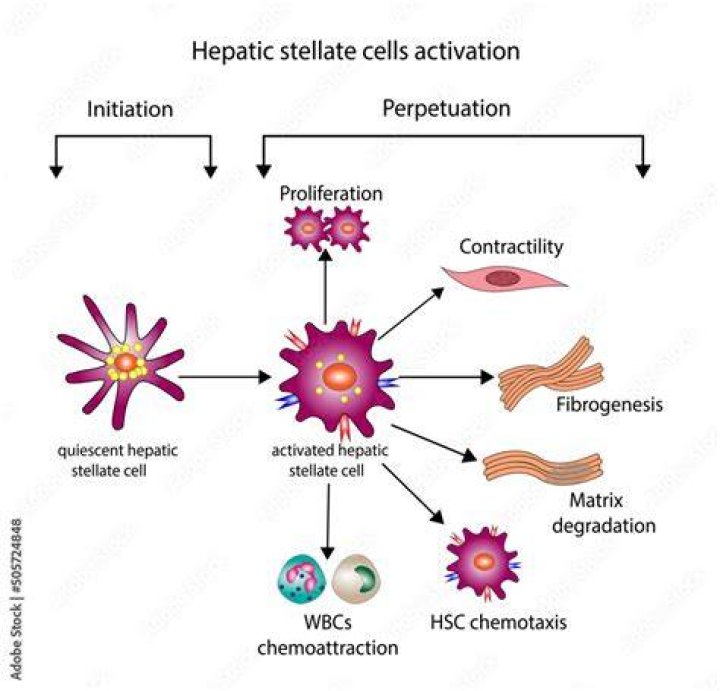 What is hepatic stellate cell activation?