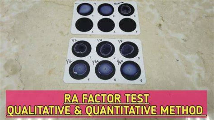 What is RF Quant test?