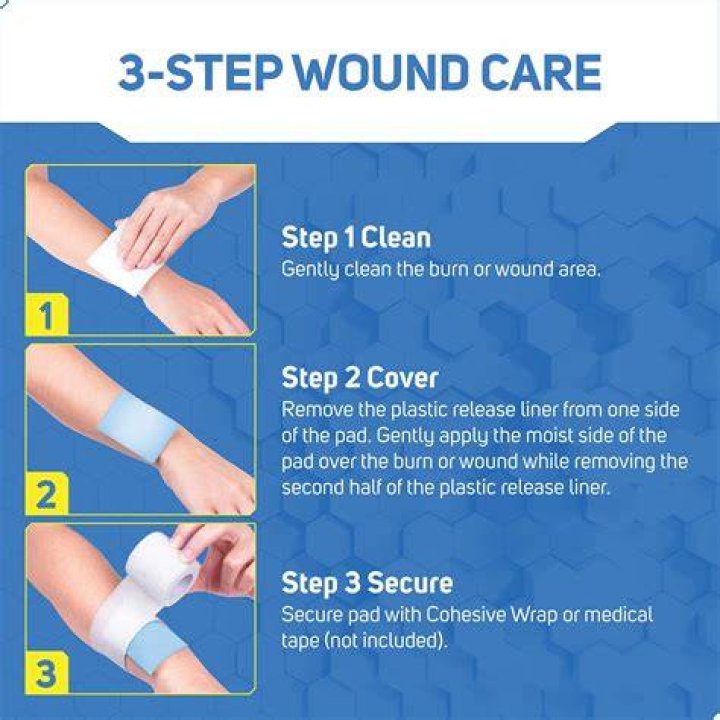 What is the best bandage for burns?