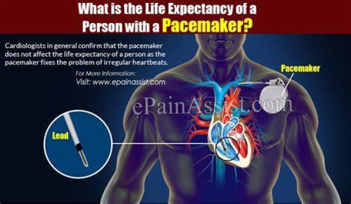 What is the life expectancy of a person with a pacemaker and defibrillator?