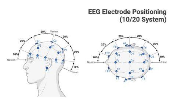 What is the number 10 and 20 refers in EEG measurement?