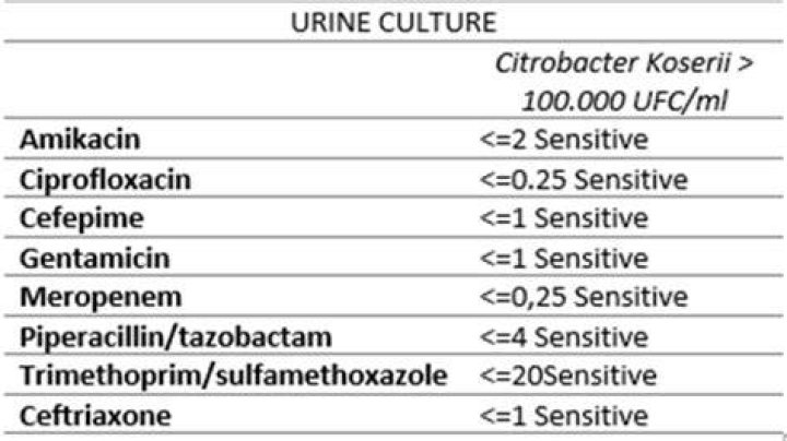 What is urine culture & sensitivity?