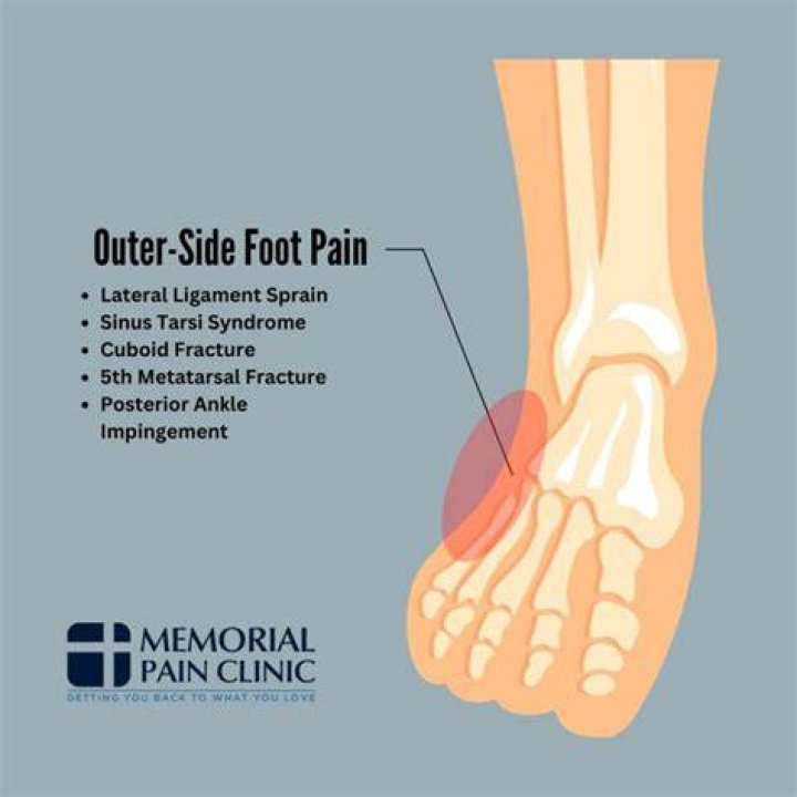 What makes the outside of your foot hurt?