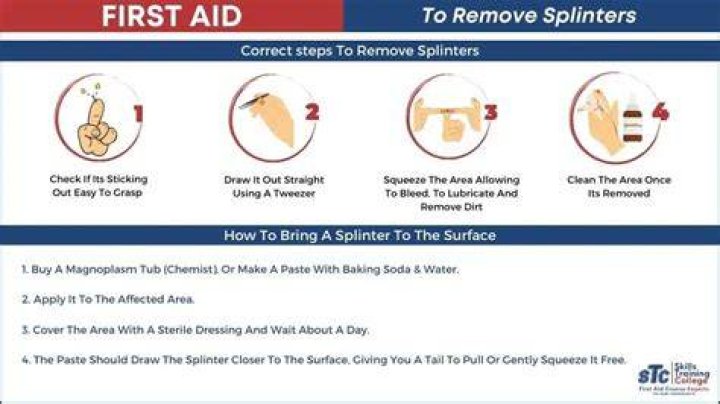 What to do if you get a splinter in your butt?