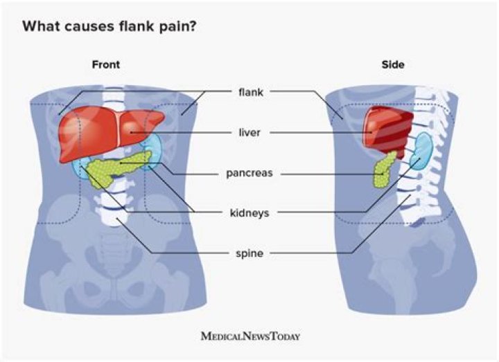 When should I worry about left flank pain?