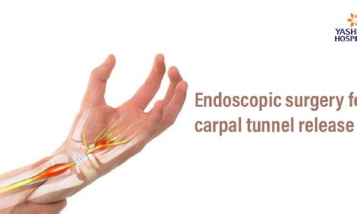 Who is a candidate for endoscopic carpal tunnel surgery?